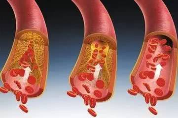 它们是清血管的“利器”，每天吃两口，血管干净通畅更长寿！