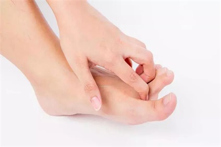 腳臭和腳氣一樣嗎？腳氣的原因有哪些？應該如何預防和治療