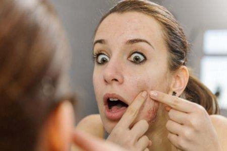 女生肌肤长痘，如果总在脸颊两侧，就要注意了