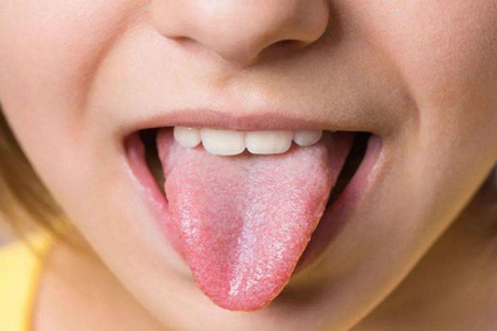 舌苔发白是什么原因，女性吃这六种食物可调理