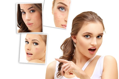 如何解决化妆品导致激素脸和皮肤长痘的元凶？