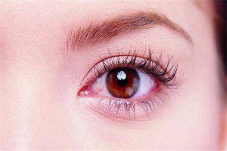 女性眼睛红血丝是怎么回事，六个小方法教你快速消除