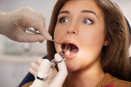 女性怎么去除牙结石，五个方法让你有一口好牙