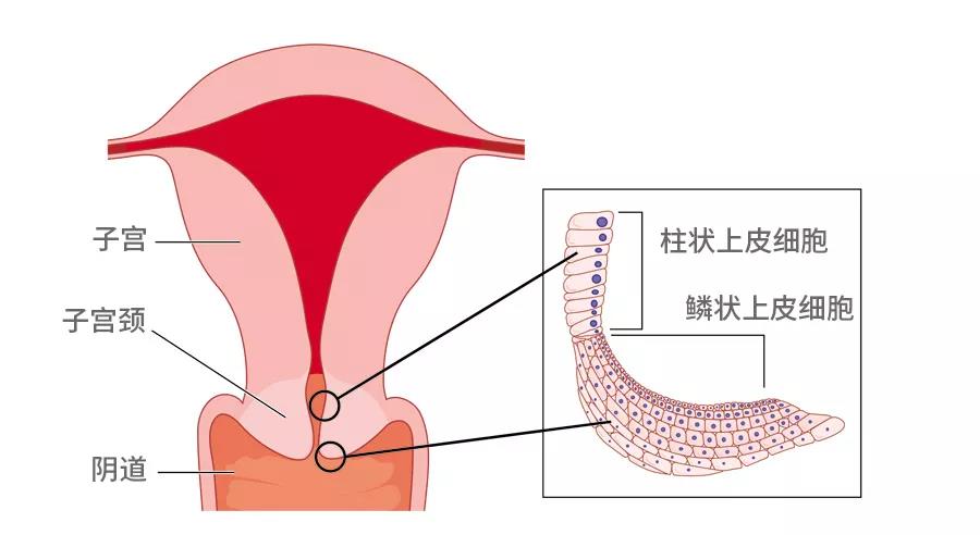 女性不要再受騙了，宮頸糜爛不是病.jpg