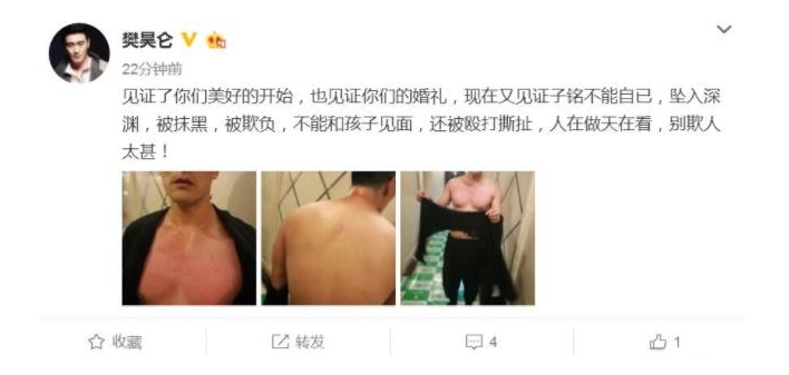 网曝赫子铭何洁尚未离婚 男方竟遭受家暴