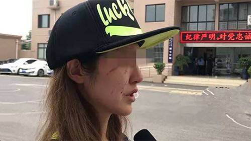 成都女主持人遛狗未拴狗绳遭暴打 引发众怒发文道歉:对不起吓到孩子了