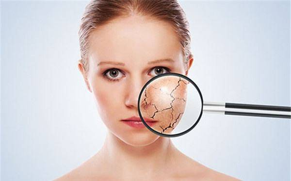 臉部皮膚過敏怎麼辦 教你幾個小方法