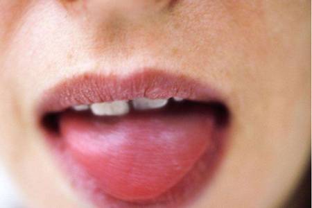 舌苔厚白的原因，除了上火还有可能是这种疾病