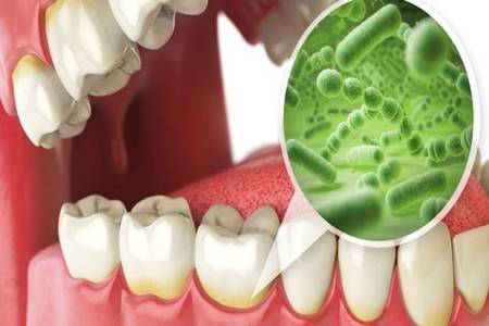 牙齦出血是什麼原因？這三個原因都會導致牙齦出血腫痛