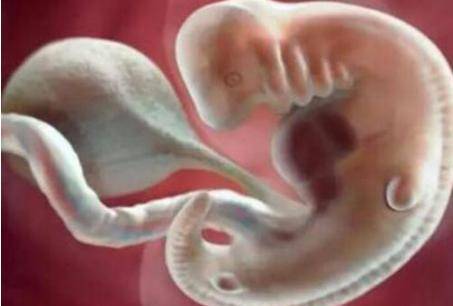 孕妇关注胎儿必知常识 哪几周是胎儿畸形的高发期