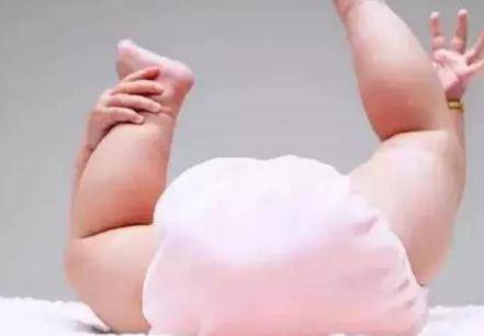 婴儿绑腿可以预防O形腿科学吗？ 绑腿会给宝宝带来哪些危害？