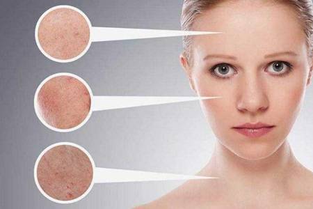 干燥敏感肌用什么护肤品效果最好  适合干燥敏感肌的护肤品推荐大全