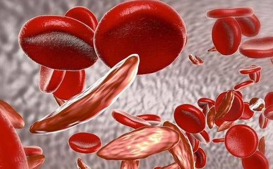 貧血是什麼原因造成的 貧血吃什麼效果好？