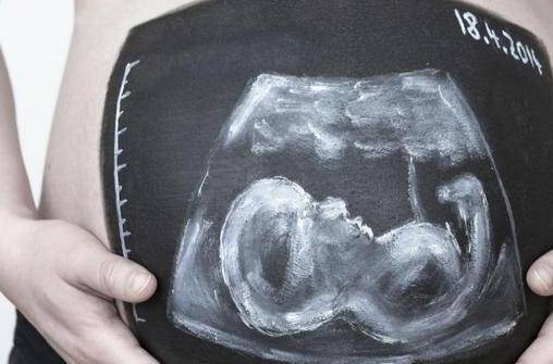 懷孕12周要做哪些檢查 胎兒12周真實樣子如何？