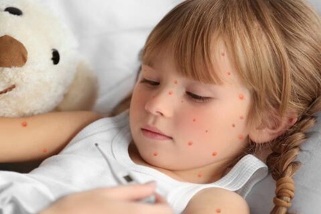 水痘的症状和治疗,患有水痘应如何护理？