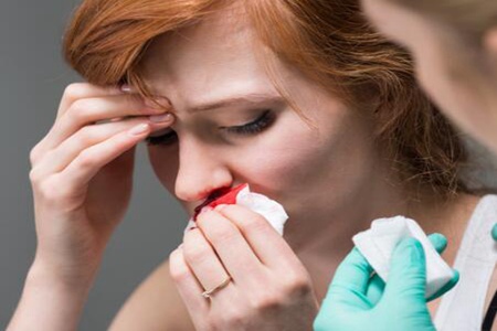 鼻子流鼻血什么原因导致的？（这五个流鼻血的原因及时改善）