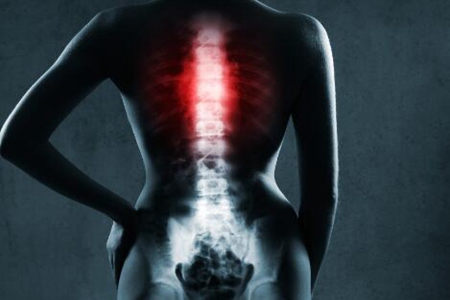强直性脊柱炎的早期症状是什么？（这五个症状脊柱或已病得不轻）