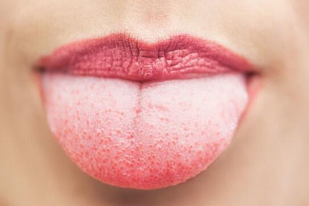 舌苔厚发黄是什么原因？这四个因素引发得及时调理