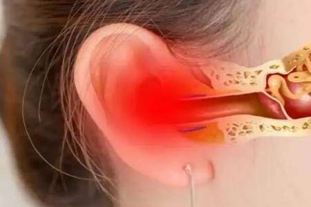 耳鸣怎么弄能马上消除？这五个方法帮你赶走耳鸣痛苦