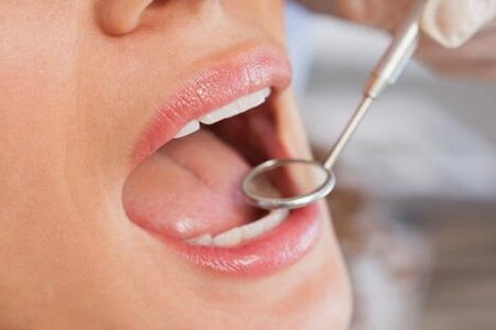牙周炎怎么治療？這五個治療方法能改善牙周炎癥狀